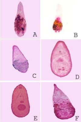  Heterophyes Heterophyes:  A Tiny Trematode Capable of Making Big Trouble for Humans!