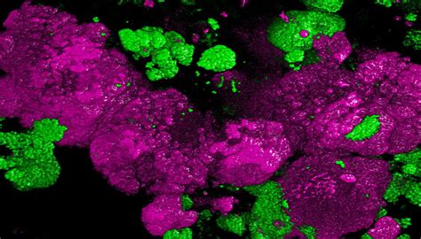  Quadrulepa! Discover the Enigmatic Microbe with Its Remarkable Quadruple Nature