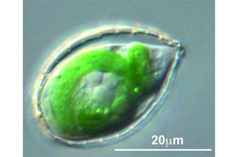  Uroglena! Unveiling the Mysteries of this Tiny, Photosynthetic Amoeboid