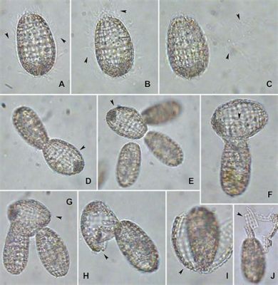  Coleps: A Tiny Twirling Tornado Terrorizing Tiny Algae!