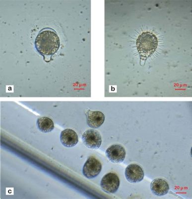  Strombidium:  The Tiny Dancing Ciliate That Conquered the Microscopic World!